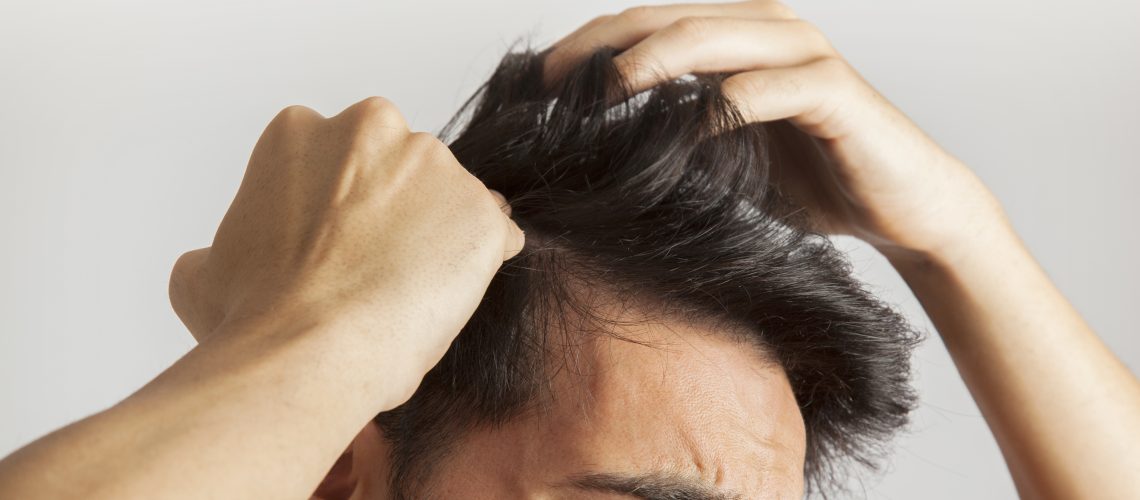 10 causas de perda de cabelo e como resolver